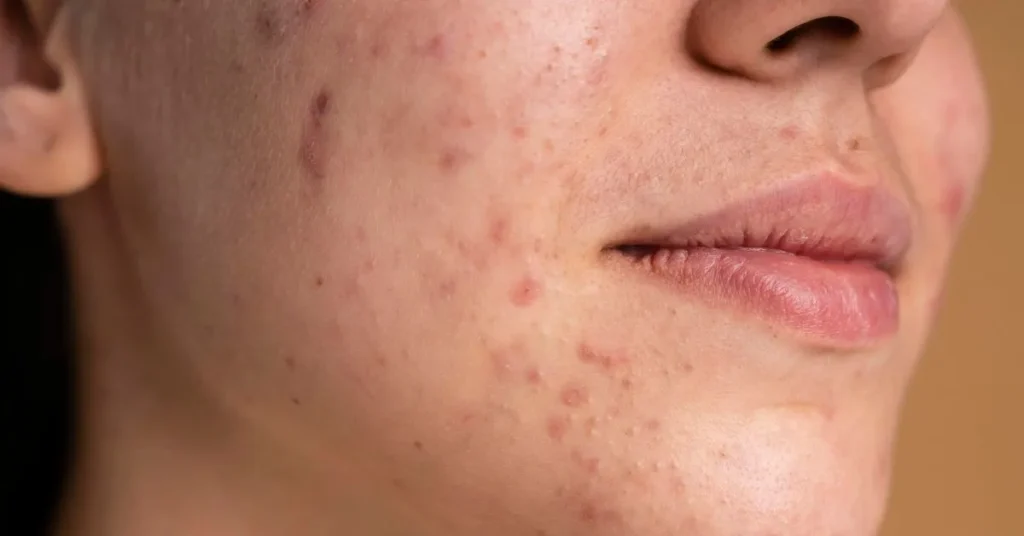 skin