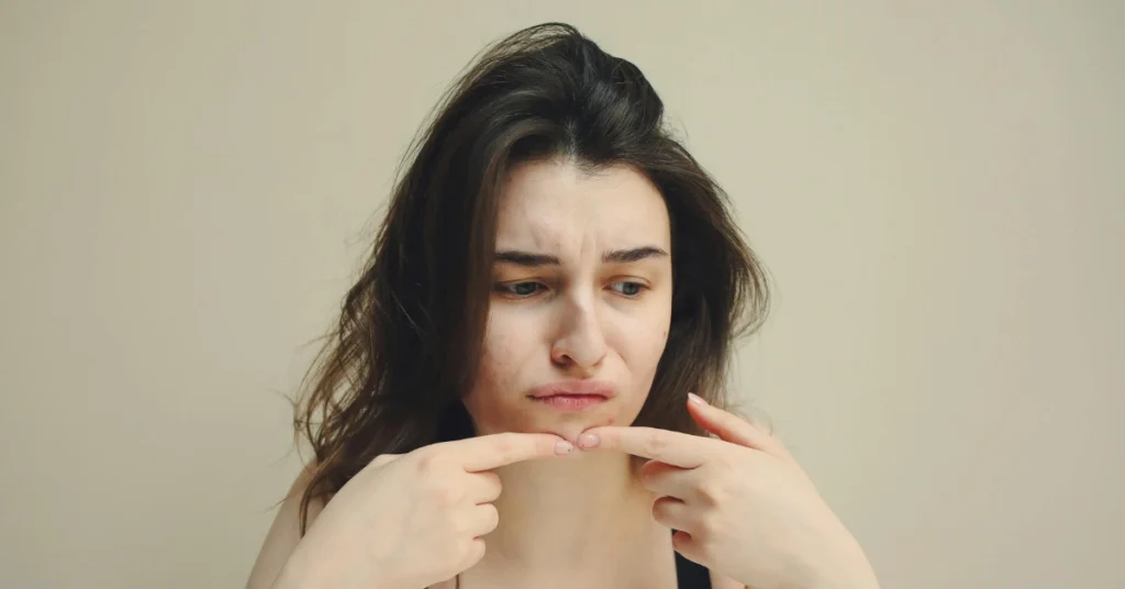 Skin barrier